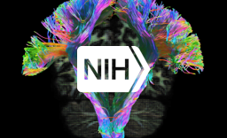 NIH logo in front of a brain